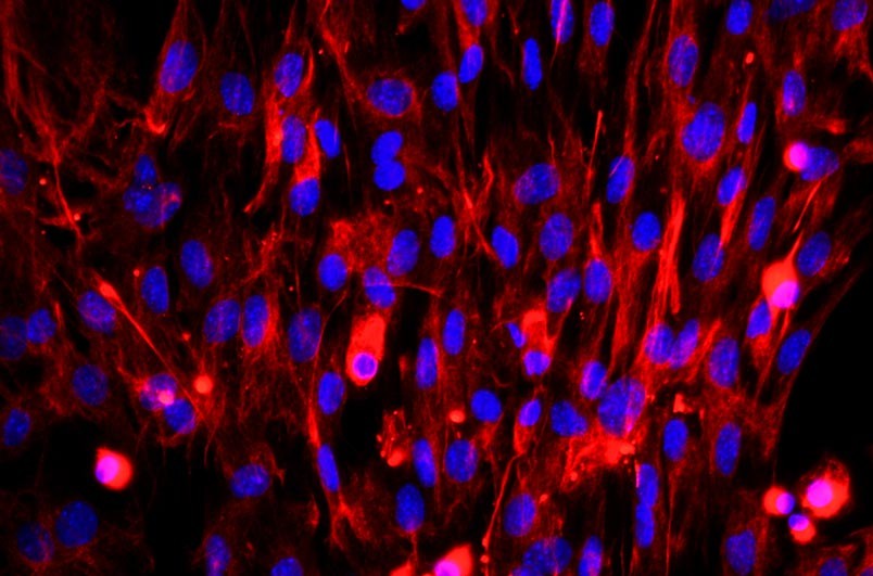 小鼠胚胎成纤维细胞主图