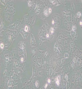 Caov-3人乳突状卵巢腺癌细胞主图