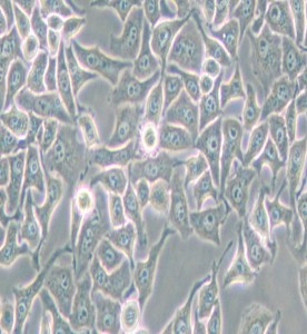 Hela-S3人宫颈癌细胞