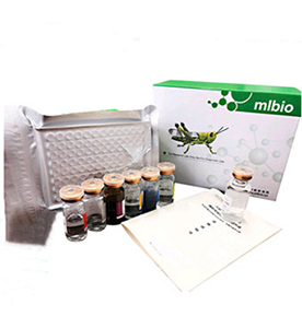 大鼠C-反应蛋白(CRP)试剂盒主图