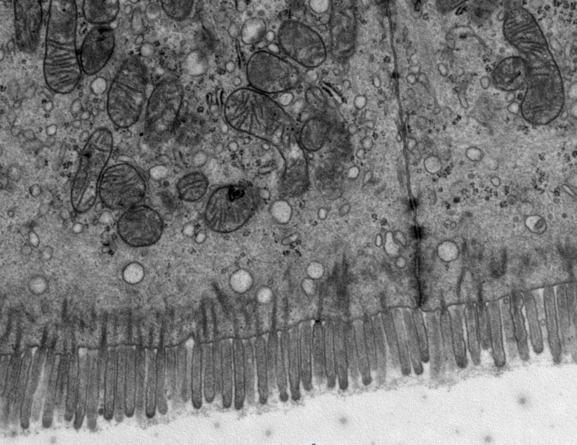 TEM透射电镜全套主图