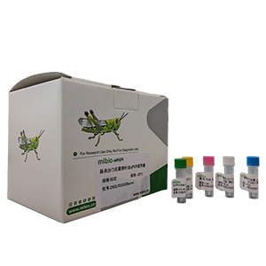 流行性出血热病毒探针法qRT-PCR试剂盒(不含内参)主图